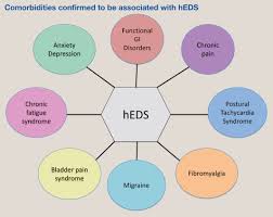 Image result for Connective Tissue Disorder