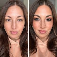 Does anyone else's labs come back completely normal? But you feel like crap  everyday?