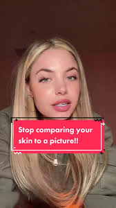 Why You Should Stop Comparing Your Skin to Instagram Pictures
