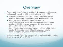 Ehlers Danlos Syndrome Eds Ppt Download