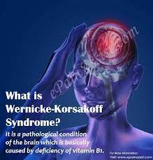 Wernicke S Syndrome