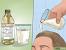 How To Remove Dandruff In One Day