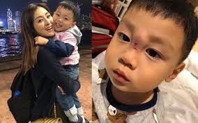 張名雅大仔酒店跳大床失足撞傷鼻- 家庭生活易family.esdlife