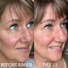 Thank you Sharmin Khan for your video. Although these are my first I like  the results. Nowhere near hers but Im new 😊 I can't believe what's  happening with the cells.