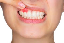 How To Prevent Gum Disease: Modern Age Dentistry: Dentists