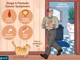 Prostate cancer may spread ( metastasize) and form tumors in nearby organs or bones. Stage 4 Prostate Cancer Treatments And Prognosis