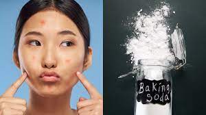 Sodium bicarbonate, or baking soda, is a fantastic product for. Fakta Penggunaan Baking Soda Untuk Hilangkan Jerawat