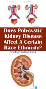 Pin On What Is Kidney Disease