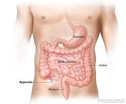 Appendix Cancer | Baptist Health Miami Cancer Institute