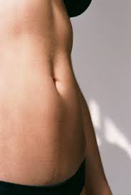 Belly Button Cosmetic Surgery Trend Umbilicoplasty