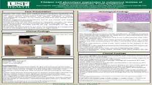 These include skin rashes, joint pain, and some blood abnormalities. Eposters T Helper Cell Phenotype Expression In Cutaneous Lesions Of Angioimmunoblastic T Cell Lymphoma