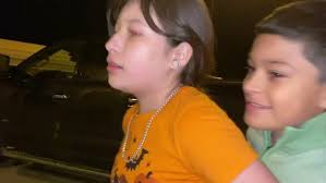 Bald Eagle with Necrotic Face Injury