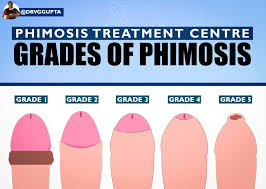 Image result for Phimosis