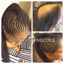 14 Extraordinary Alopecia Camouflage Cornrows By Braids By Necole Kids Braided Hairstyles Cornrow Hairstyles Alopecia Hairstyles