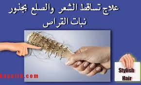 علاج تساقط الشعر والصلع بجذور نبات القراص علاج تساقط الشعر بالاعشاب youtube
