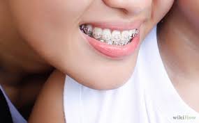 Also tooth enamel grows in layers. Best Ways To Relieve Soreness From Braces
