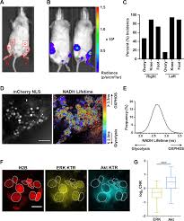 There is no other evidence of myeloma anywhere else in the body. Ex Vivo Imaging Of Cancer Cells In Bone Marrow Recapitulates Metabolic Download Scientific Diagram