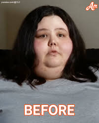 WOW, YOU LOOK AMAZING!" a user exclaimed upon seeing photos of Christina  Phillips' SLIMMED-DOWN FIGURE.🤩 The star of "My 600-Lb Life" HAD LOST 536  LBS.😱 COMPARISON PHOTOS are in the comments below.