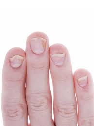 Wenn Deine Fingernagel So Aussehen Konntest Du Krank Sein Wunderweib