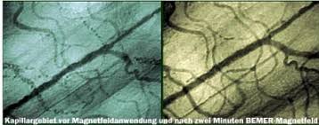 Die bemer mat ist keine eigenständige form der behandlung, sondern ein technologisches hilfsmittel, mit dem magnetfeldimpulse in den menschen. Neue Studienergebnisse Zur Wirkung Der Magnetfeldtherapie Tipps Vom Experten