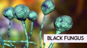People think black fungus is contagious and can pass through contact or oxygenation or by use of humidifier. Black Fungus Treatment Facility Launched At Bouring Hospital In Bengaluru Oneindia News