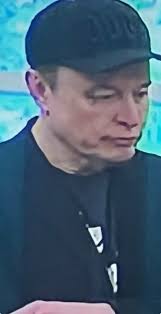 Does Elon Musk have a bruise