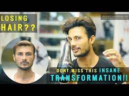 Non Surgical Hair Replacement Hair Patch Wigs For Men In Mumbai Youtube Hair Replacement Hair Hair Replacement Systems