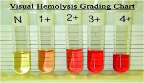 visual grading for serum and plasma color images available