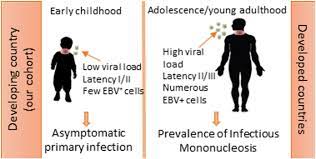 The virus spreads through saliva, which is why it's sometimes called kissing disease. mono occurs most often in teens and young adults. Distinctive Ebv Infection Characteristics In Children From A Developing Country International Journal Of Infectious Diseases