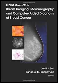 Breast cancer can occur anywhere in the breast, but the most common location is the upper, outer section of the breast. Recent Advances In Breast Imaging Mammography And Computer Aided Diagnosis Of Breast Cancer Spie Press Monograph Vol Pm155 9780819460813 Medicine Health Science Books Amazon Com