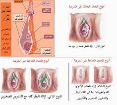 حيوانات أليفة اذهب للمشي على ختان النساء الكبار comertinsaat com