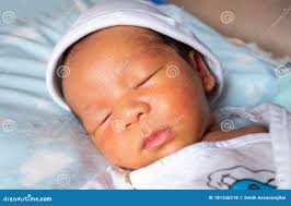 La Piel Amarilla Bebe Nace Amarillo Puso Amarillo Bebes Que Nacen Amarillos  La Piel Amarilla Bebe