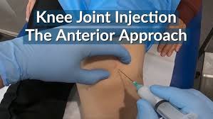 Image result for Knee Injection