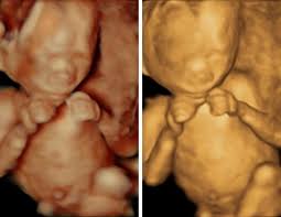Once they're born, it's over. 22 Week 3d Ultrasound Pictures A Date With Baby