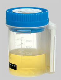 Icup 4 Panel Urine Drug Test Thc Coc Mamp Opi