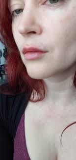 Meet The Professionals At RO Aesthetics