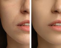 Image result for Dry Skin