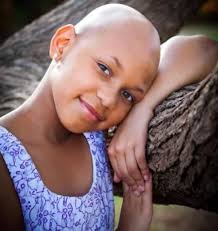 A mother raises awareness for her child's hair loss disease