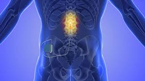 Interventional Pain