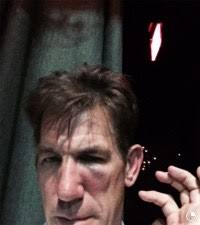 Thomas Ravenel releases photo of injury from attack