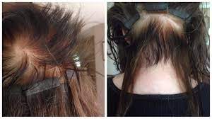Garnier Olia Makes You Hair Fall Out And Will Be Classed As An Inconvenience By Garnier Every Two Weeks For Y Garnier Olia Hair Falling Out Fall Hair