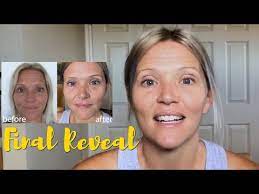 Beverly hills md dermal repair complex is a supplement that believes beauty begins from within. Dermal Repair Complex Review Does Beverly Hills Md Work