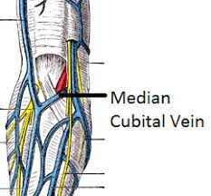 Choose from 25 different sets of flashcards about median cubital vein on quizlet. Median Cubital Antebrachial Veins Locations Functions Study Com