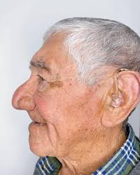 Tratamiento de conducto realizado por la Dra. Oriana ¿Te has atendido con  la Dra. Oriana? ✓ Horarios de atención: Lunes a viernes: 10:00 a 17:30  Sábados: 9:00 a 14:00 #moron #buenosaires #dentista #odontologia  #dentistaenmoron #tratamientodeconducto