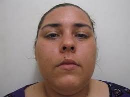 City employee bitten