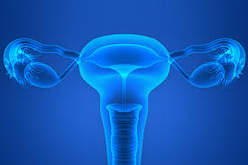 By the time ovarian cancer is considered as a possible cause of these symptoms, it usually has already spread. Ovarian Ca Risk And C Reactive Protein