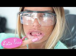 22.10.2020 · katie price 'horrified' as teeth fall out before getaway with boyfriend carl woods. Katie Price Teeth Reconstruction Horrific Youtube