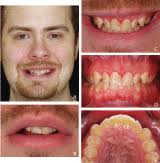 Table of Contents page: The Journal of Prosthetic Dentistry