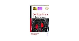 Image result for Genitourinary Tuberculosis