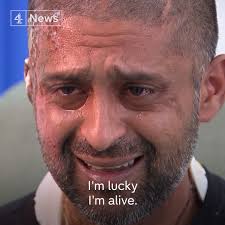 Acid attack victim Jameel Muhktar tells his shocking story